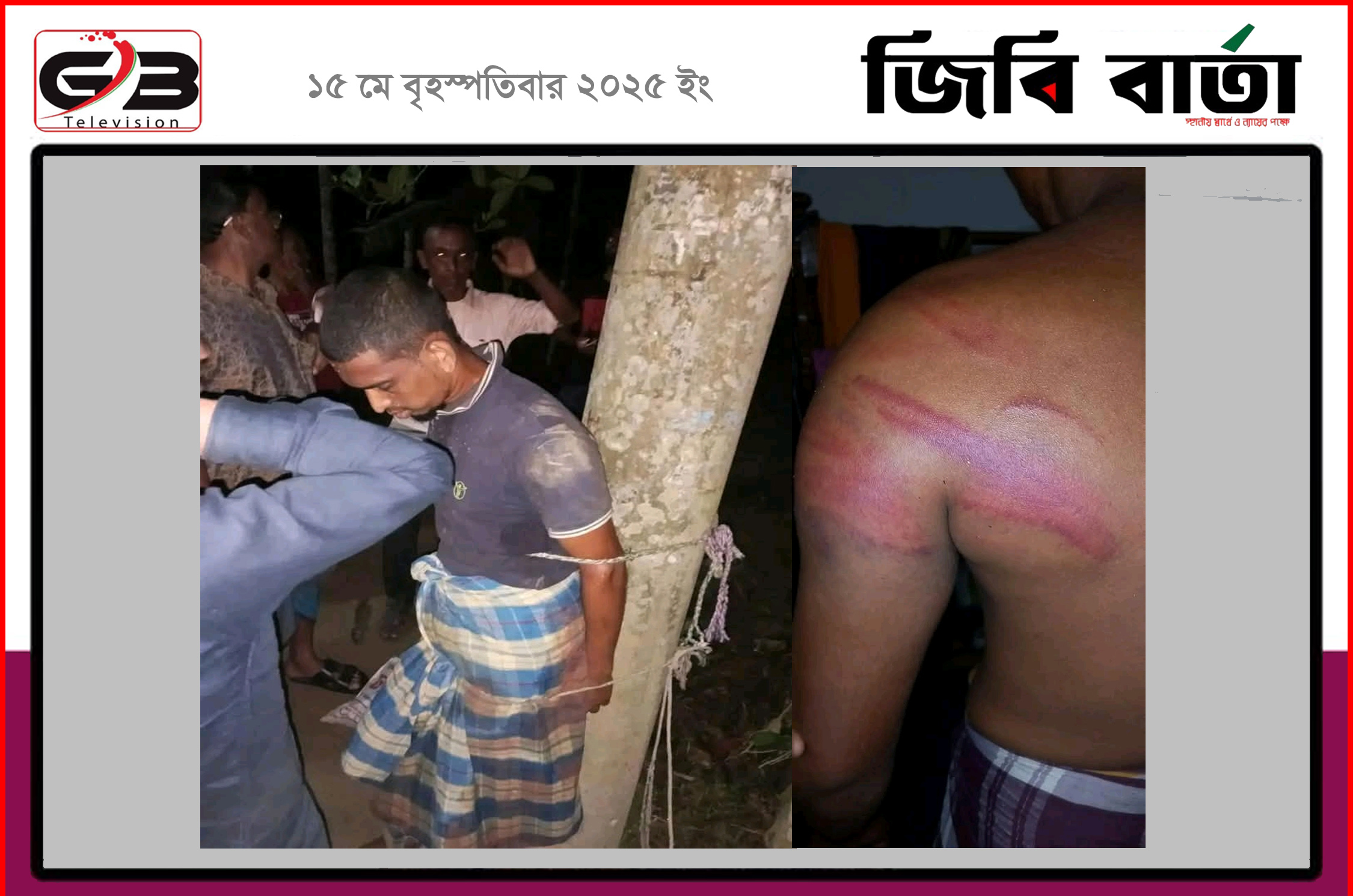 কমলগঞ্জে বুদ্ধি প্রতিবন্ধীকে বিদ্যুতের খুটিতে বেঁধে পিটিয়ে আহতের অভিযোগ