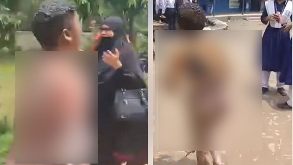 পোড়া শরীর নিয়ে বের হচ্ছেন একের পর এক শিক্ষার্থী